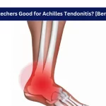 Are Skechers Good for Achilles Tendonitis [Benefits]